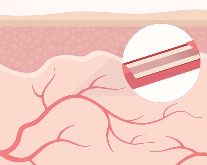 Blood Flow & Sensitivity